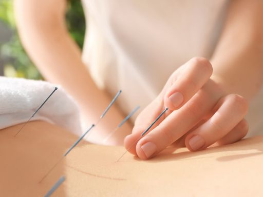 Acupuncture for high blood pressure in dubai