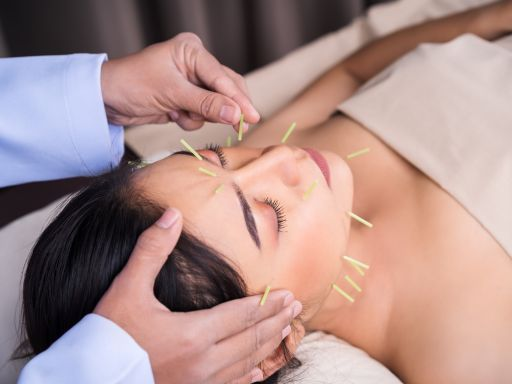 Facial Acupuncture Treatment in Dubai